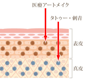 アートメイクとは