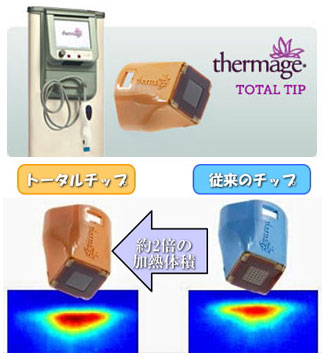 トータルチップが痛みを変えた!