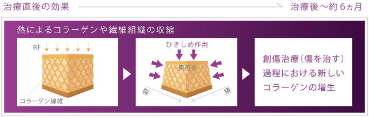 治療直後の効果