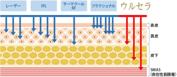 コラーゲンを効果的に増やすために