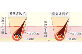 蓄熱式