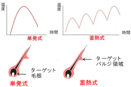 単発式