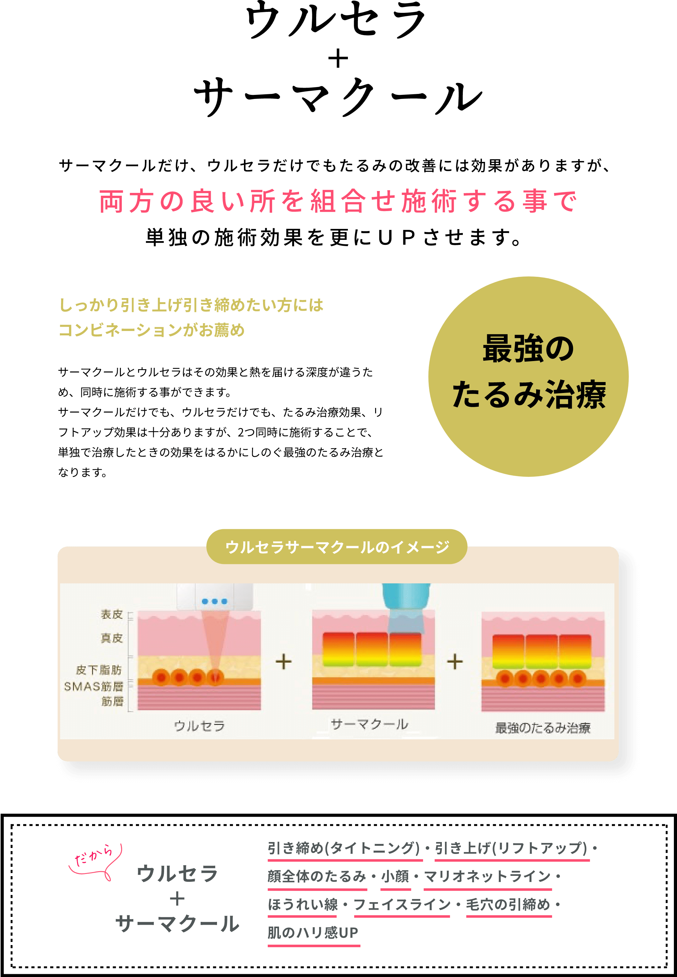 ウルセラ+サーマクールについて