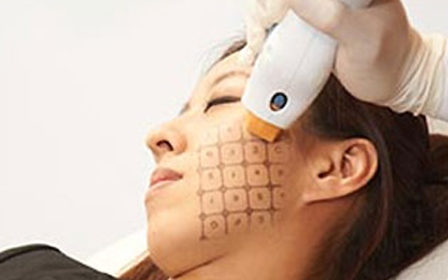 専用の器械を使った施術の画像