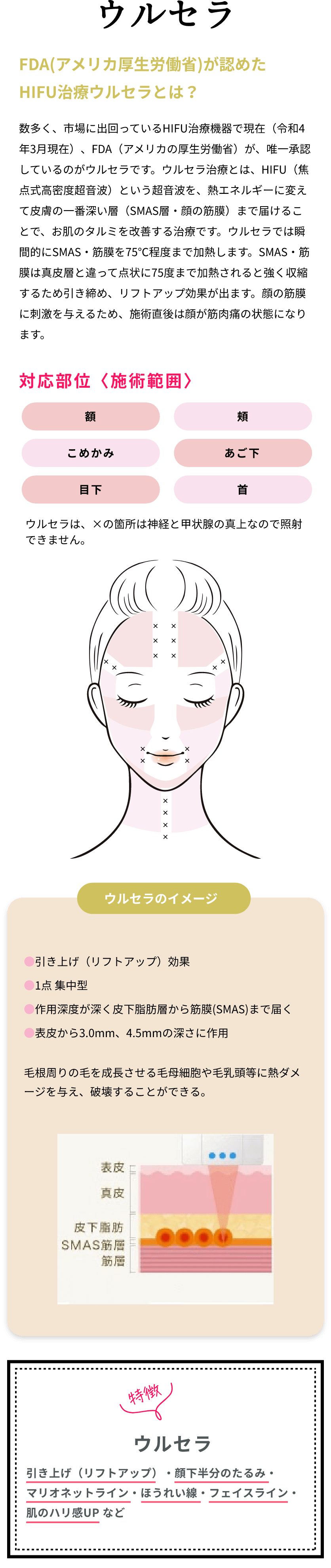 ウルセラについて