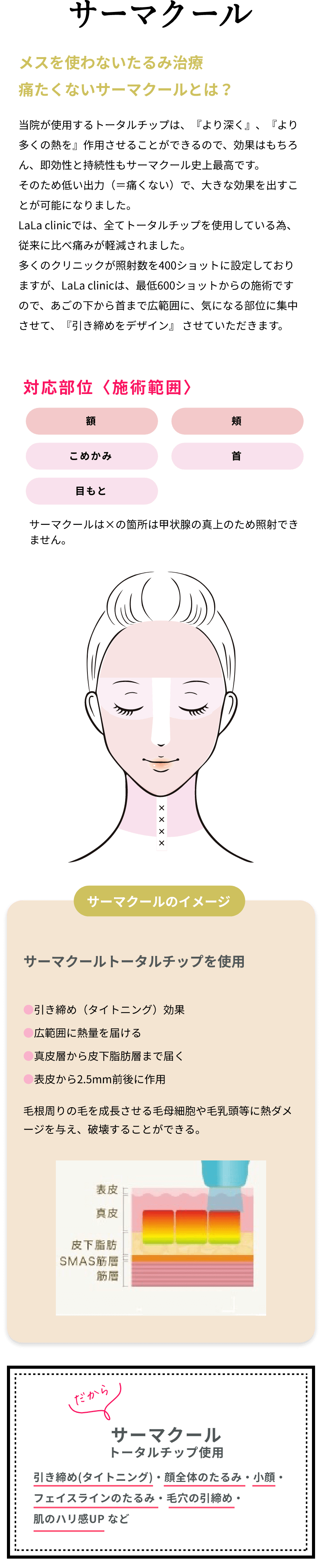 サーマクールについて